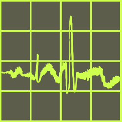 Sound Wave Clipart: Green and Black Design for Creative Projects